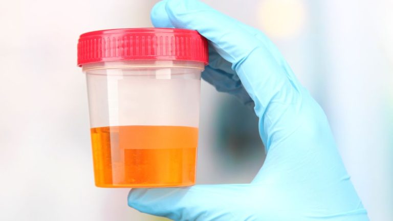 flacon de test urinaire