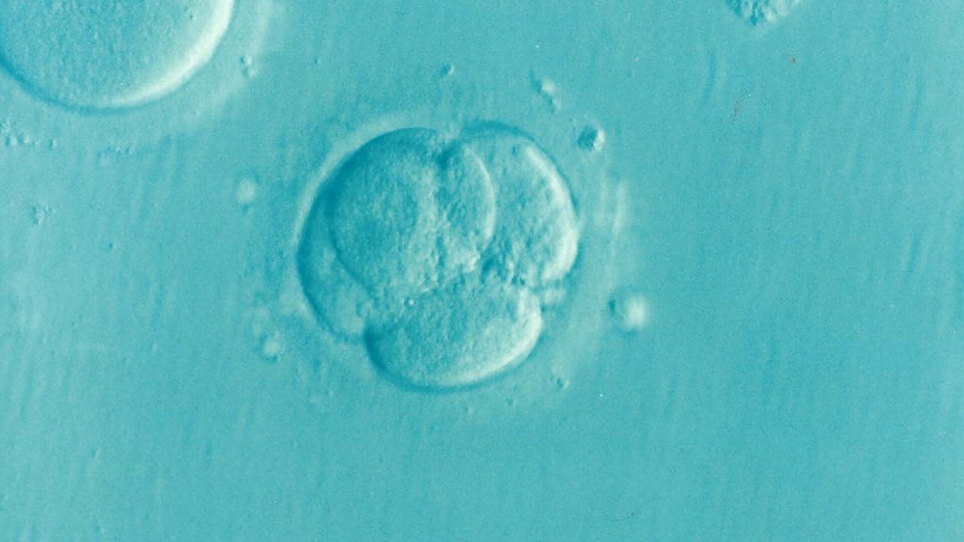 Les scientifiques identifient une cause clé de l'infertilité féminine