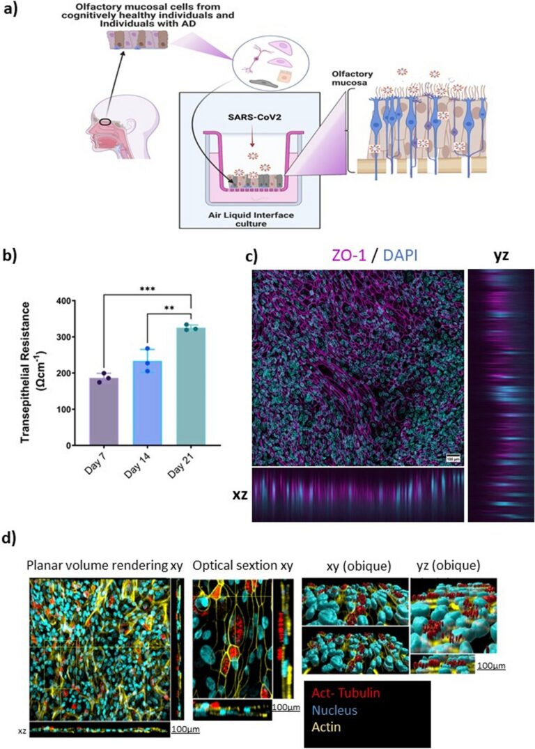 Une étude montre que l’infection au COVID-19 modifie la transcription génétique des cellules de la muqueuse olfactive dans la maladie d’Alzheimer