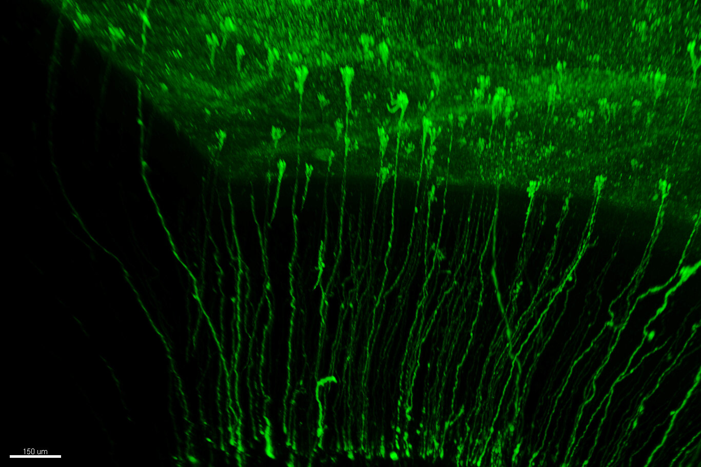 Une étude révèle plusieurs lignées de cellules souches contribuant à la production de neurones