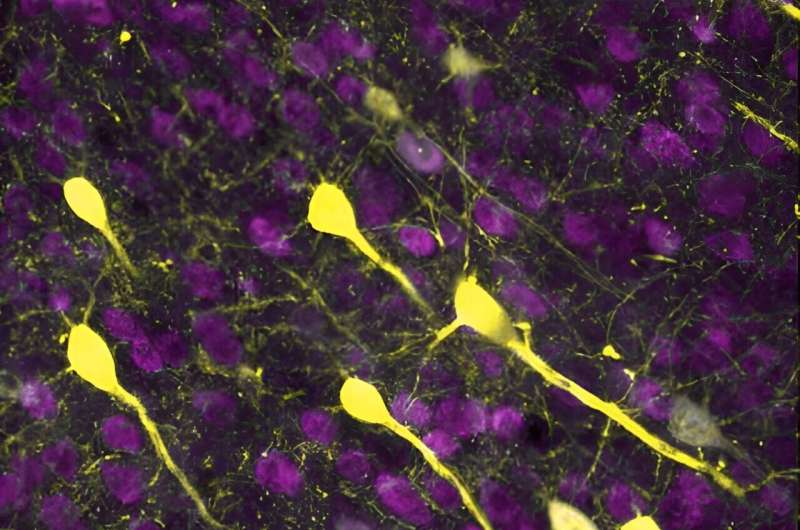 Comment le cerveau enflammé se déconnecte après un accident vasculaire cérébral