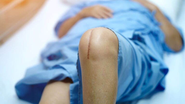 L'exercice et l'éducation sur la douleur ne soulagent pas la douleur chronique après une arthroplastie du genou