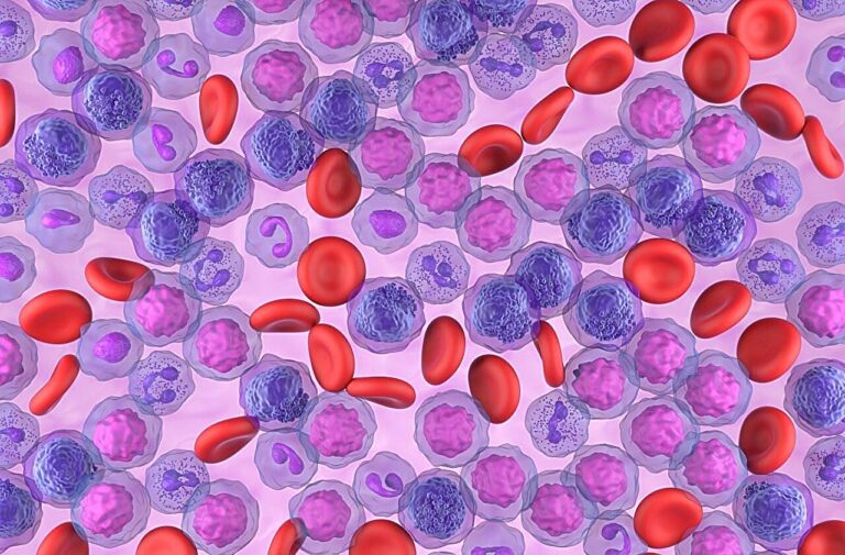 La prophylaxie de la GVHD par cyclophosphamide après transplantation est bénéfique dans la leucémie
