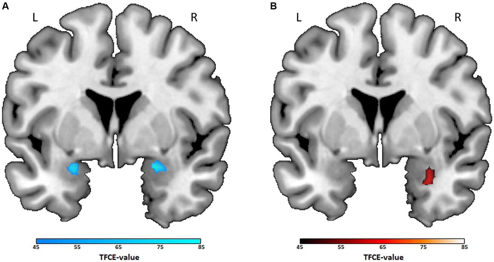 Une étude d'imagerie montre ce que vos genres de films préférés révèlent sur votre cerveau