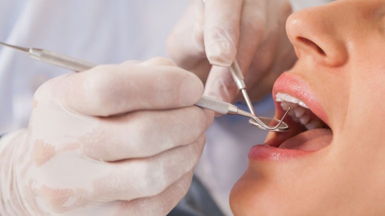 soins de dents bouche ouverte chez dentiste