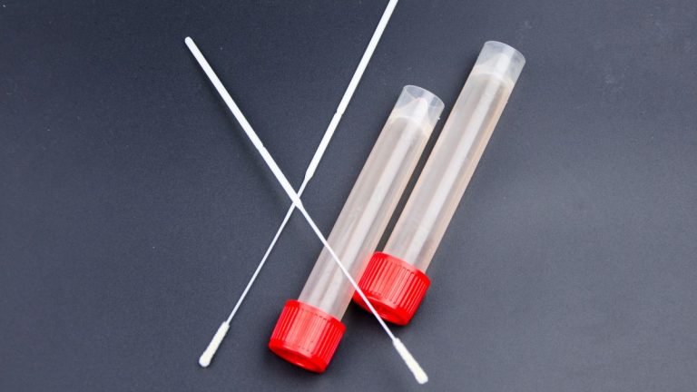 ecouvillons et tubes analyses